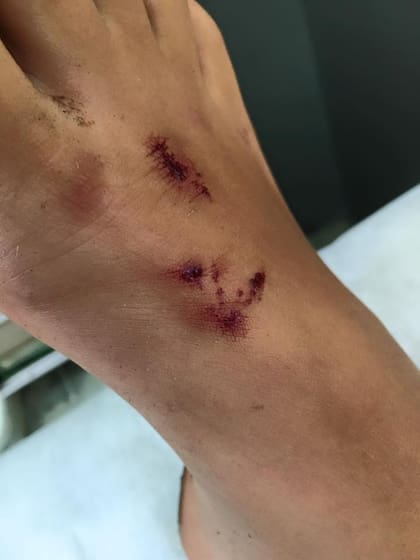 Así le quedó el pie a la chica