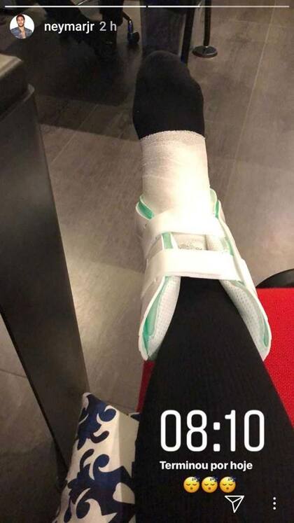 Así le quedó la pierna a Neymar