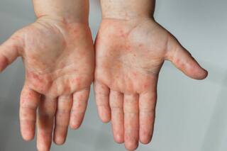 Las dos dificultades para contener el brote que muestran los primeros estudios internacionales