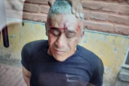 Así quedó el delincuente tras recibir el cabezazo del policía tucumano.
