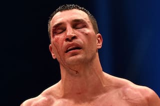 Así quedó el rostro de Klitschko, quien explicó el porqué de su derrota