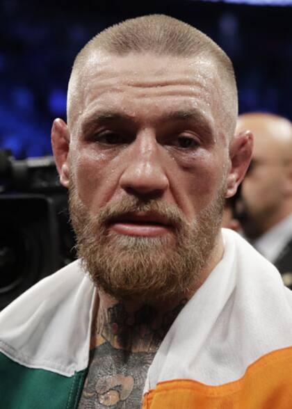 Así quedó el rostro de McGregor, el perdedor