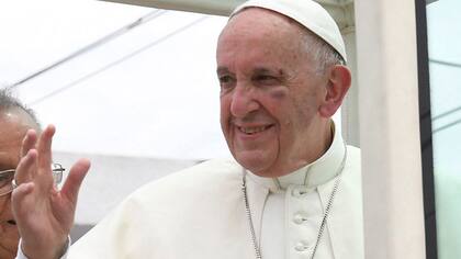 Así quedó el rostro del Papa luego del golpe