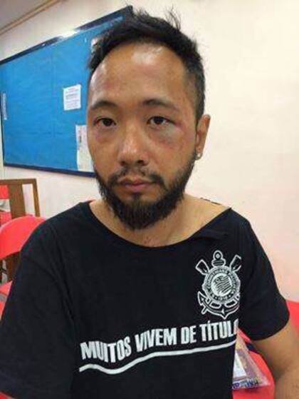 Así quedó Ken Tsang, según los activistas