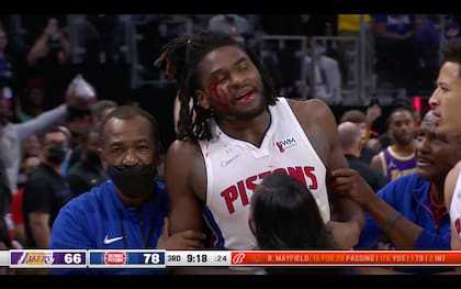 Así quedó la ceja derecha de Stewart tras recibir un duro codazo por parte de LeBron James