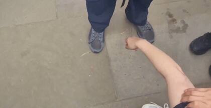 Así quedó marcada la mordedura en el brazo de la mujer