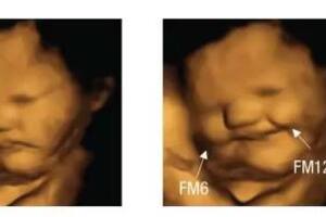 El estudio que mostró que los bebés en el vientre “sonríen” cuando sus mamás comen zanahorias y “fruncen el ceño” cuando comen kale