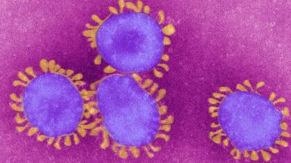 Así se ve el coronavirus bajo el microscopio Fuente:BBC/Getty Images