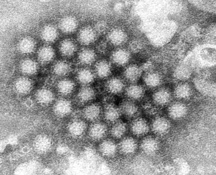 Así se ve un grupo de viriones de norovirus a través de un microscopio
