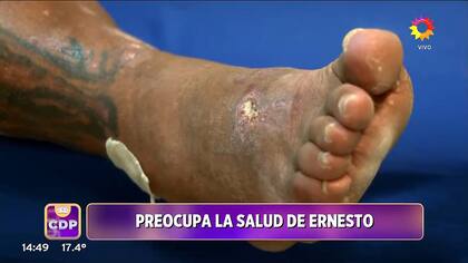 Así tiene los pies Ernesto