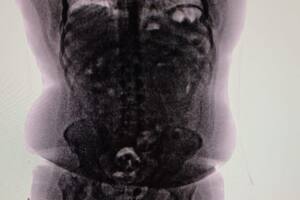 El caso de la “mula” que para la Justicia era una “bomba de tiempo”