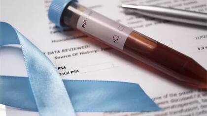 Aunque el hallazgo es prometedor, es muy pronto para saber si las bacterias son causantes de los casos de cáncer de próstata.