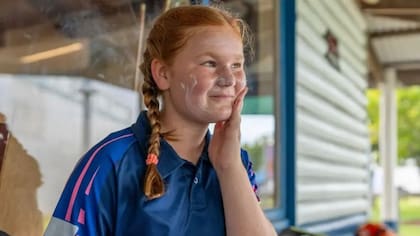 Australia es la nación con las tasas de cáncer de piel más altas del mundo