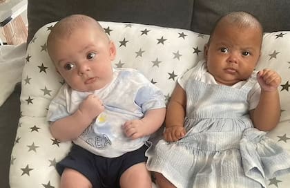 Ayon y Azirah nacieron en Nottingham, Inglaterra y han asombrado por tener tonos de piel tan distintos