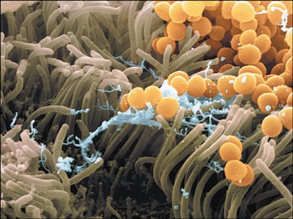 Bacterias intestinales