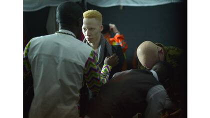 Bambalinas en el certamen de belleza albina