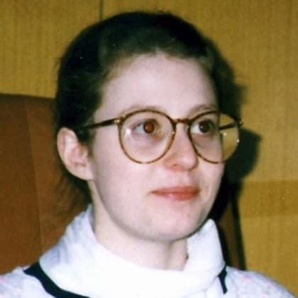 Barbora Skrlová era una mujer de 33 años que padecía hipopituitarismo, enfermedad que le daba la apariencia de una niña de 13 años