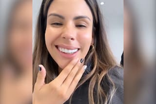 Barby Franco fue al dentista y mostró el impresionante efecto que tuvo la anestesia: "Me re pegó"