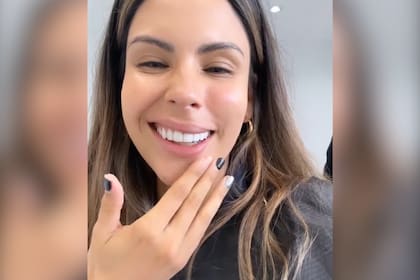 Barby Franco fue al dentista y mostró el impresionante efecto que tuvo la anestesia: “Me re pegó”