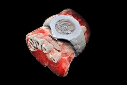 Basado en un chip desarrollado por el CERN, este equipo puede tener un nivel de precisión para identificar y representar en 3D y a color desde músculos, huesos y liquidos hasta elementos externos como un reloj, en este caso