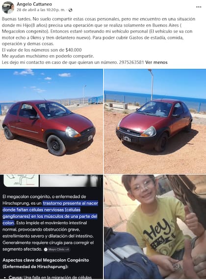 Bastian debe viajar el próximo mes al Hospital Garrahan para someterse a estudios complejos y a una intervención quirúrgica definitiva (Foto: Facebook /@angelocattaneo)