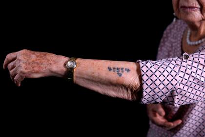 Batcheva Dagan, sobreviviente de Auschwitz muestra las marcas de su cuerpo