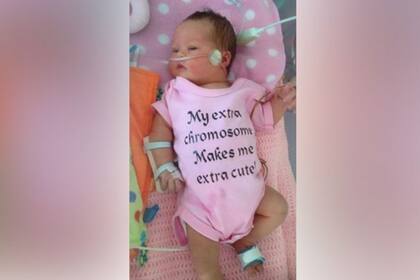 A Jaimie le diagnosticaron síndrome de Down al nacer, pero no tiene otras complicaciones de salud. 