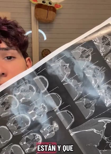 Behringer, hace un mes, mostró los estudios que determinaron su problema de salud