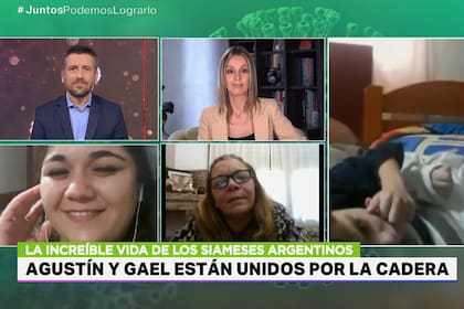 Belén y su madre hablaron con Juntos Podemos Lograrlo (Telefe) y contaron la historia de los hermanos siameses argentinos