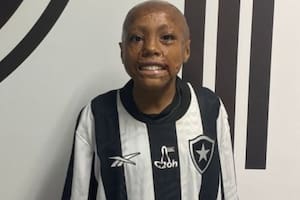 Sufrió un accidente cuando era un bebé, los médicos pronosticaron lo peor pero se equivocaron