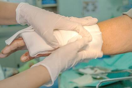 Bissell informó haber recibido 183 reportes de agua caliente o vapor escapando del limpiador, incluidos 157 casos de lesiones menores por quemaduras (Archivo)