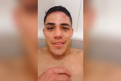Brian Castaño, después de la pelea: atendió el llamado de LA NACION mientras recuperaba fuerzas en la bañera.