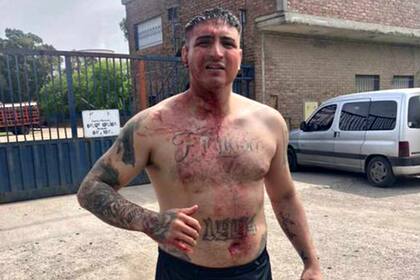 Brian Medina, nieto del Pata Medina, ayer, tras la pelea con la facción de Iván Tobar