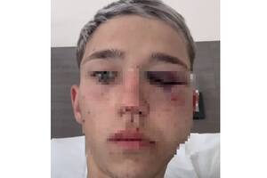 Brutal golpiza a un joven de 16 años que asistió a un cumpleaños