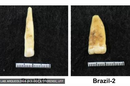 "Buscamos analizar dientes en lugar de huesos, porque el ADN dentro de los dientes tiene más protección".