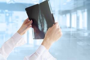 Tres claves que redefinen el abordaje médico del tumor más frecuente en mujeres y replantean los tratamientos