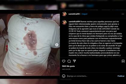 Camila Medina reveló detalles sobre la agresión que sufrió (Foto Instagram @camioficial94)