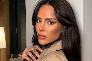 Cande Tinelli sorprendió al iniciar el proceso para eliminar un tatuaje de su cara