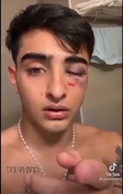 Captura del video de Patricio Ledezma subido a sus redes sociales