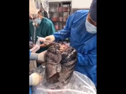 Captura del video difundido por el médico chino.