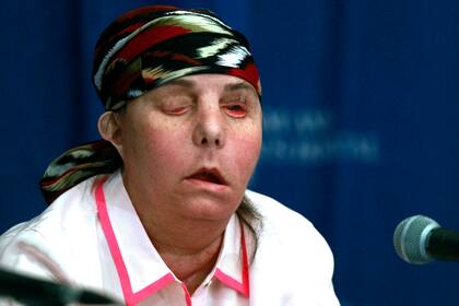 Carmen Blandin Tarleton luego de su primer traspalante de cara