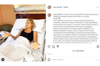 Carolina Oltra se realizó una cirugía (Foto Instagram @caro_oltra)