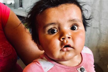 Cassandra de 8 meses se realizó un chequeo de rutina