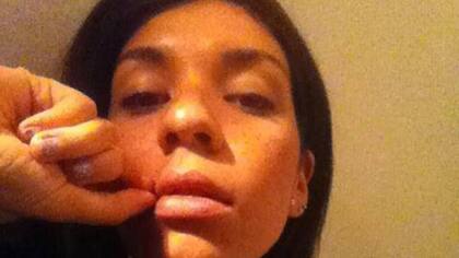 Caterina Scicchitano