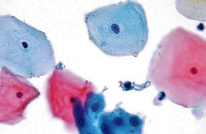 Células correspondientes a un PAP normal (400x)