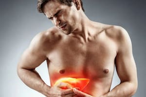 Hígado graso: cuál es el endulzante que tenés que eliminar de tu dieta para tratarlo