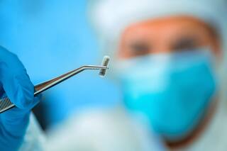 Chips bajo la piel: implantes inteligentes para abrir puertas o viajar en tren