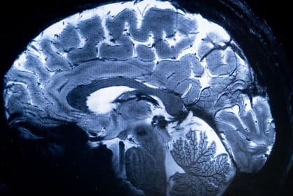 Los continuos intentos de encontrar huellas materiales de memoria en el cerebro han revelado cada vez más problemas y la idea de la transmisión de la memoria a través de la resonancia mórfica se ha vuelto aún más plausible