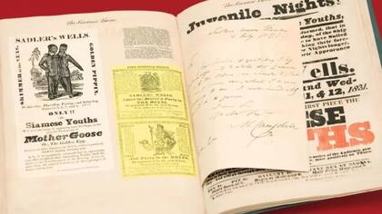 Chang y Eng Búnker fueron exhibidos como curiosidad circense