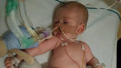 Charlie Gard no llegará a su primer cumpleaños, dijeron sus padres